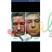 تجميل حصري بالخلايا الجذعيه